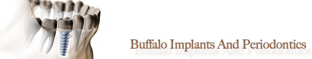 Buffalo Implants and Periodontics